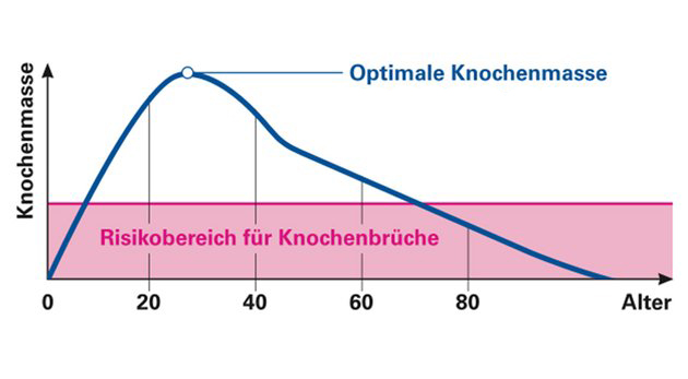 Zusammenhang zwischen Alter und Knochenmasse